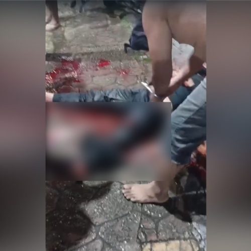 Grave acidente na zona centro-sul deixa motociclista com fratura exposta